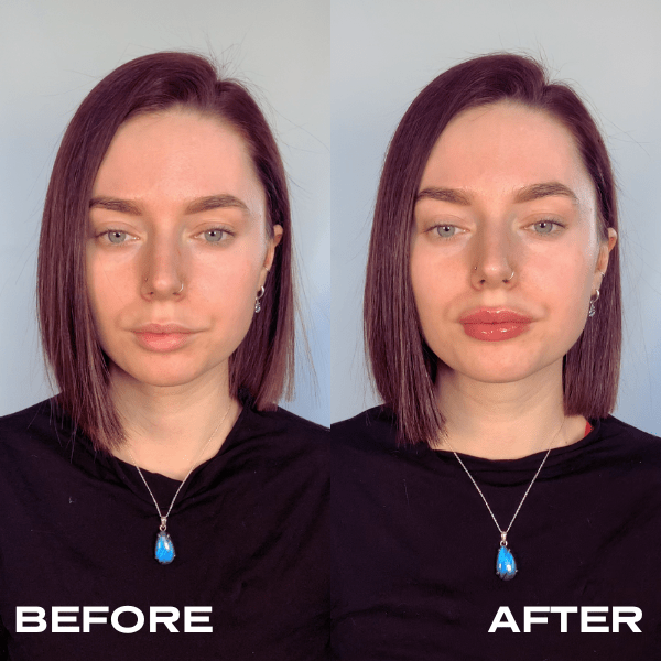 No Needles Lip Filler Kit Plump it! No Needles Lip Filler Kit Plump it!