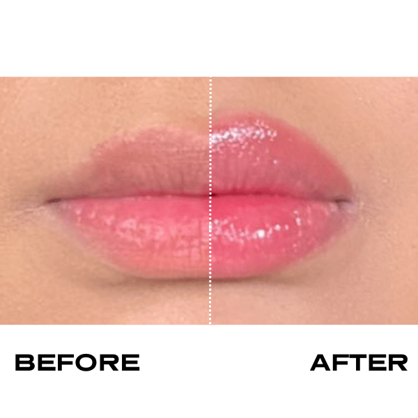 No Needles Lip Filler Kit