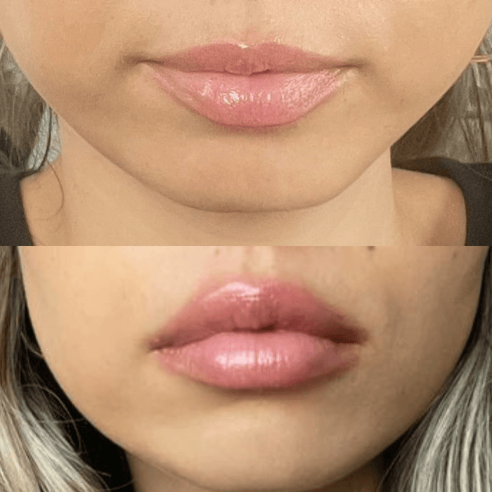 Volumising Lip Plumper