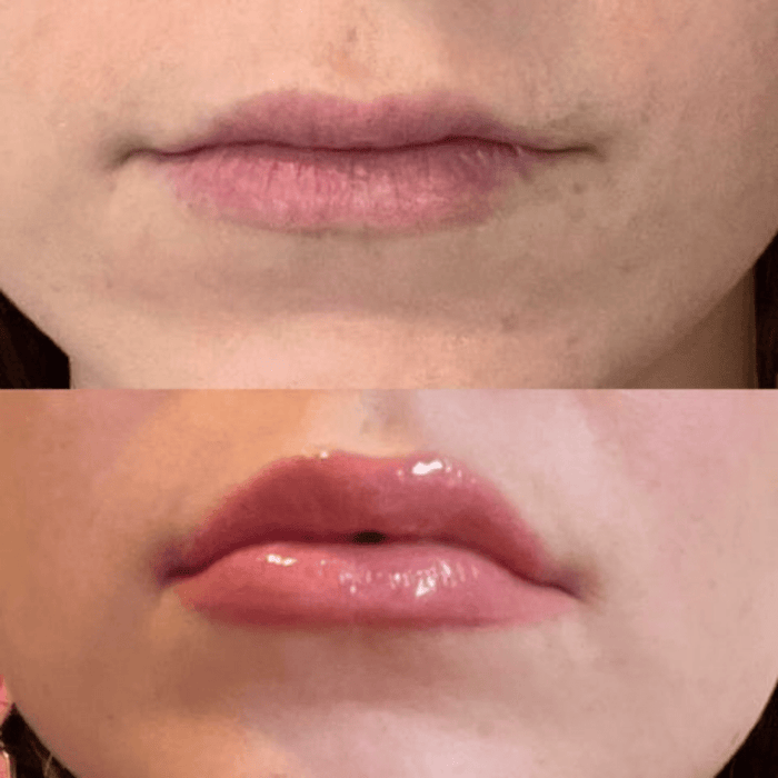 Volumising Lip Plumper